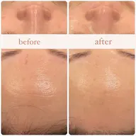 【美肌コルギ80分】憧れのすっぴん美人へ✨うるつやピーリングで美肌に