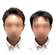 【顔出しNG】薄毛に悩む方のカット、シャンプー、ヘアセット。ホームページ、SNS等掲載用のお写真、動画の撮影。
