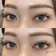 バインドロック 300本(100束)