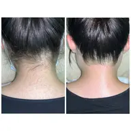 【学生から人気】うなじWAX(産毛・くすみケア)