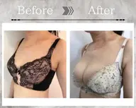 【✨️大人気モニター募集✨️】全身施術３回コース🩵