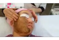 【スポンジアハーブピーリング】美容大国韓国から導入🌿本気の肌質改善‼️整形級✨