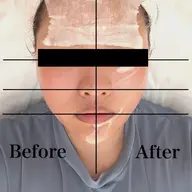 【毎月3名限定✨】美白&小顔リフトアップ超音波エステ🧖