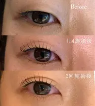 瞼のリフトアップ!眼精疲労にも【ダブルアイリフト】まつ毛パーマ×アイストレッチで瞼のたるみ、むくみを撃退!