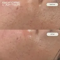 【お肌のベースを整える】フェイシャルワックス