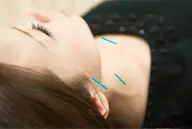 （初回）美容鍼人気NO1【美容鍼+全身調整鍼+幹細胞化粧水】スタンダードコース