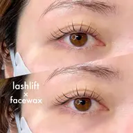 お肌つるつるっ✨フェイシャルワックス脱毛🧡