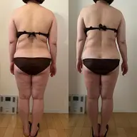 筋膜リリース＆セルライト対策