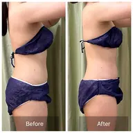 【人気No.2】深部筋膜×腸もみ×ヘッド🌱結果重視！体の不調を根本改善🌟 全身120分