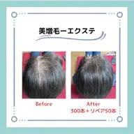 🌈増毛エクステ🌈薄い生え際、薄毛、白髪隠しのトップに🥰ファイバー毛を地毛一本に2〜4本結びつけます💕お試200本