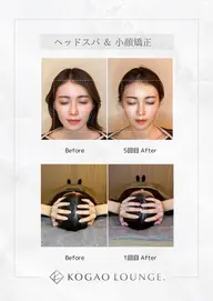 【人気NO.1✨】小顔に特化したヘッドスパ+小顔ケア¥14,000→¥3,000