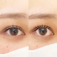 【ラッシュリフト上下】中顔面短縮/逆さまつげ解消