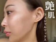 艶肌産毛ケア💖【フェイシャルWAX】鎮静美白パック付✨¥7500→¥4500