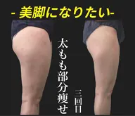 下半身サイズダウン⭐️夏に向け🦵徹底‼️筋膜脂肪アプローチ