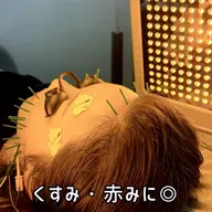 【赤み・くすみケア】光美容LED×美容鍼×EMS