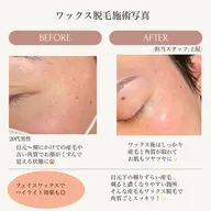 眉毛Wax脱毛×お顔のWax脱毛(美肌パック付)
