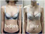 💗今流行りの最新バスト💗育乳マッサージ＆光豊胸＆EMSでマシュマロバストへ👙✨贅沢2回コース✨