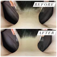 【ミニモ 限定】脇orVライン100円🌼