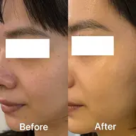 【敏感肌】❤️お試し❤️天然由来100％で安心。鎮静・保湿・再生を叶え1回で透明感・ハリを実感♪￥12000→￥3980