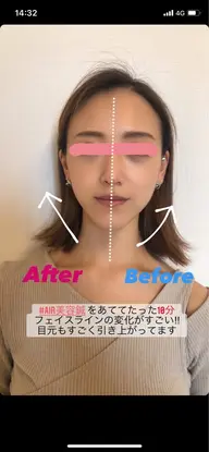 【美白＆小顔】トリートメント+ヘッドスパ付　(EMS付で首肩こりもスッキリ！)