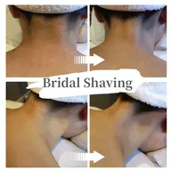 ブライダルシェービング