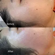 お顔に優しいマツヤニフリーフェイスワックス