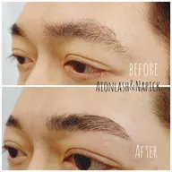 メンズハリウッドブロウリフト