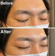 アイブロウケア+鼻毛ワックス　(レディース・メンズ)  通常6600円