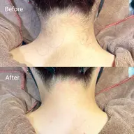 【後ろ姿スッキリ綺麗✨】うなじワックス脱毛🤍