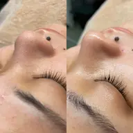 20代からの毛穴・ざらつき集中改善フェイシャル