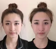 小顔美肌 :90分8000円。60分6000円(美容パック無し)