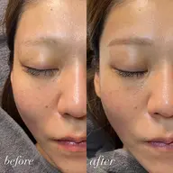 💎アイブロウスタイリング＋全顔フェイスワックス　¥14,500→10%OFF