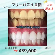 💎人気No. 1👑フリーパスコース💎美白セルフホワイトニング💎20分x20回照射¥54,000→¥39,600