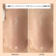 オススメ★小鼻クリーンケア＋贅沢🌿‬ハーブオフトリートメント