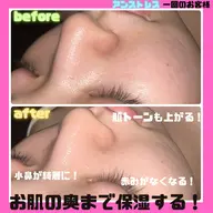 【クリスティーナ／アンストレス】✨水分のシャワーを肌の奥まで浸透させる🚿リピート率No.1！今話題の乳酸ピーリング🫧