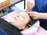【人気No.2/美容鍼】整体+骨格矯正+美容鍼 体とお顔どちら整う◎