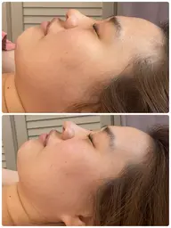 [小顔整体]フェイシャルエステ⭐︎小顔マッサージ💆コルギ以上...♪*ﾟ美容鍼以上の小顔！