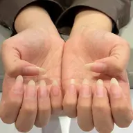 ジェルオフのみ