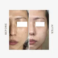 【初回限定】むくみ・くすみ改善✨即効フェイシャル ¥3,000