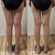 ご新規様限定¥2000オフ！下半身筋膜リリース×リンパケア45分