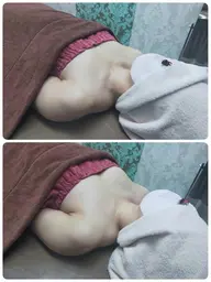 当店人気No２⭐️【左右差離れ乳撃退】→ふわふわおわん型へ🥰120分（特別カウンセリング込み💓）通常35,000円