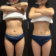 【くびれ/お腹】WINBACKお腹集中ケア🌿60分¥16,000→