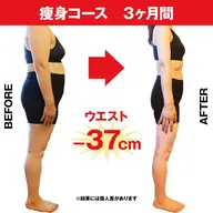 お試し痩身エステ