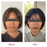 《人気No.1❤️むくみ&大きくなった顔を小さく！フェイスラインをシュッと整える》小顔矯正とヘッドコース（60分）