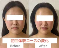 初回体験価格！　　　　　　　　　　　　　　　　　　　トライアングルフェイシャル®️