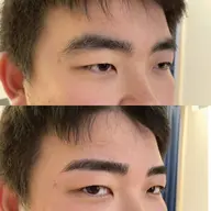 【ミニモ限定価格】眉周り光脱毛✴︎特殊な機械で細かい箇所まで光脱毛をします