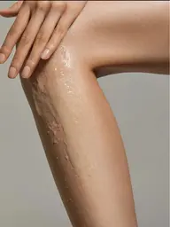 【1ヶ所◆パーツ脱毛】お好きな部位が選べる！肌に優しいピンポイント脱毛♪