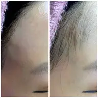 フェイシャルWax