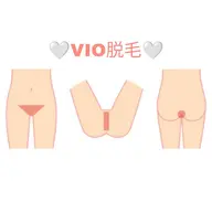 VIO脱毛クーポン🌟シェービングはこちらで🙋🏻♀️形も一緒に決められます!初めての方も是非😊へそ下も照射します