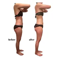 🍔本気で痩せたい人に🍔最新機器『セルライトゼロ』